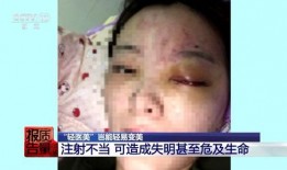 珠海医美注射事件爆料视频,揭秘美容针背后的惊悚真相